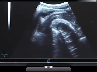 Daddy Ultrasound Deep Fuck